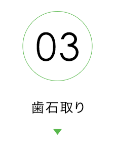 歯石取り
