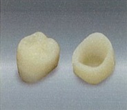 CAD/CAM冠ハイブリッド